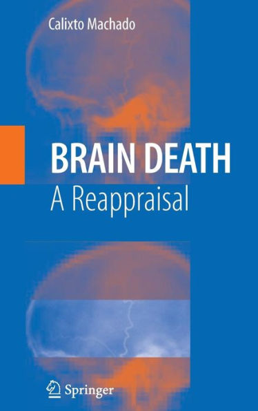 Brain Death: A Reappraisal / Edition 1