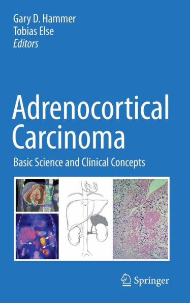 Adrenocortical Carcinoma: Basic Science and Clinical Concepts / Edition 1