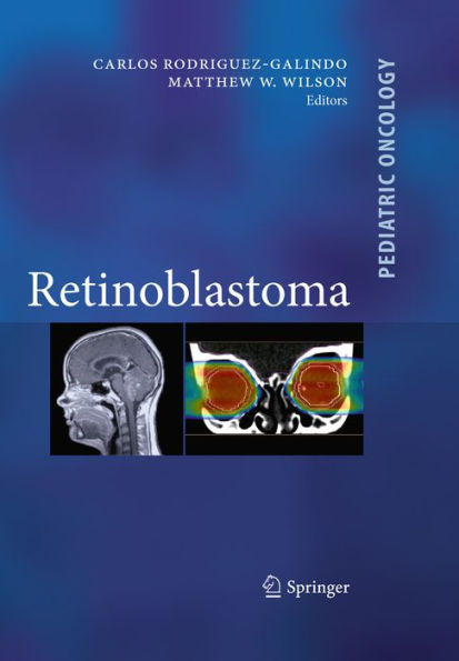 Retinoblastoma