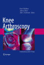 Knee Arthroscopy