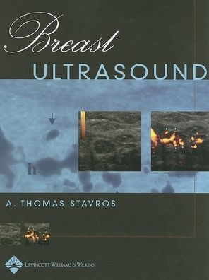 Breast Ultrasound / Edition 1