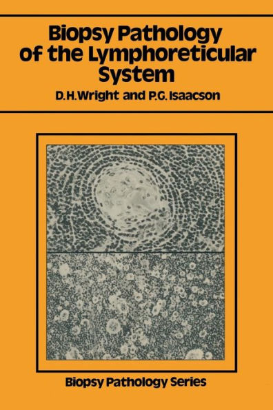 Biopsy Pathology of the Lymphoreticular System