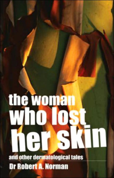 The Woman Who Lost Her Skin: (And Other Dermatological Tales) / Edition 1