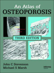 Title: An Atlas of Osteoporosis, Author: John C. Stevenson