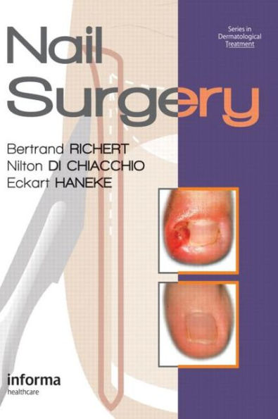 Nail Surgery / Edition 1