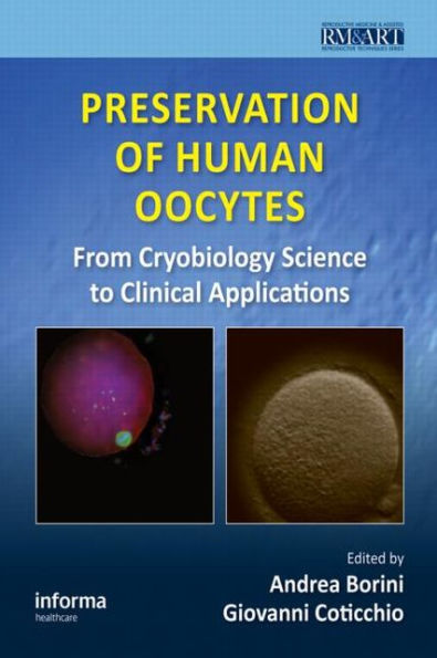 Preservation of Human Oocytes: From Cryobiology Science to Clinical Applications