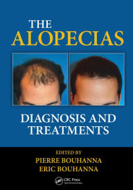 Title: The Alopecias: Diagnosis and Treatments, Author: Pierre Bouhanna