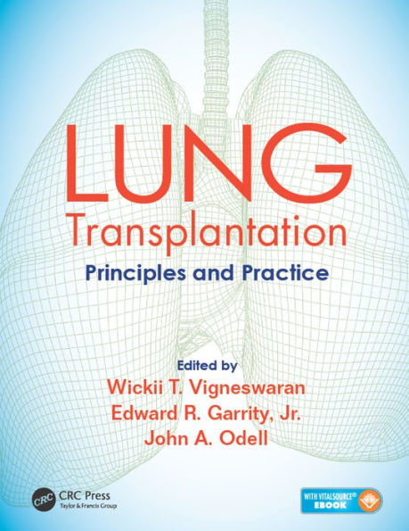 Lung Transplantation: Principles and Practice