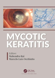 Title: Mycotic Keratitis, Author: Mahendra Rai