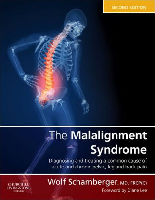 The Malalignment Syndrome: diagnosis and treatment of common pelvic and back pain / Edition 2