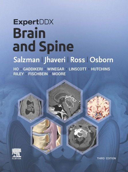ExpertDDx: Brain and Spine: ExpertDDx: Brain and Spine E-Book