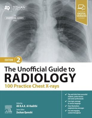 The Unofficial Guide to Radiology: 100 Practice Chest X-rays