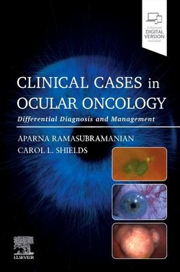Clinical Cases Ocular Oncology: Differential Diagnosis and Management