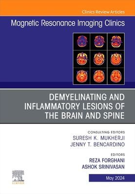 Demyelinating and Inflammatory Lesions of the Brain Spine, An Issue Magnetic Resonance Imaging Clinics North America