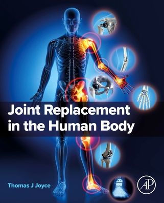 Joint Replacement the Human Body