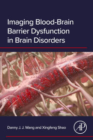 Title: Imaging Blood-Brain Barrier Dysfunction in Brain Disorders, Author: Danny J.J. Wang PhD