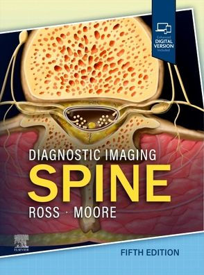 Diagnostic Imaging: Spine