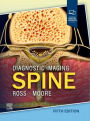Diagnostic Imaging: Spine