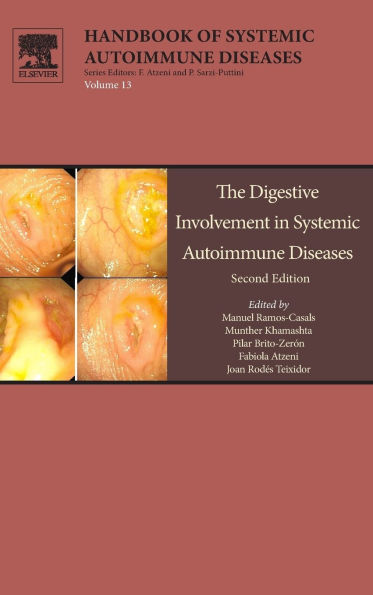 The Digestive Involvement in Systemic Autoimmune Diseases / Edition 2