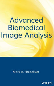 Title: Advanced Biomedical Image Analysis / Edition 1, Author: Mark Haidekker