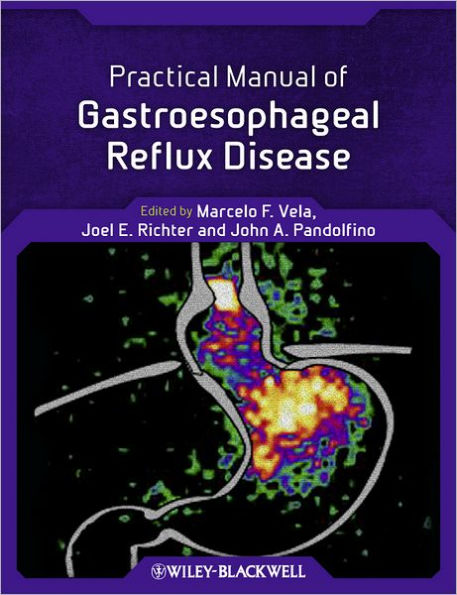 Practical Manual of Gastroesophageal Reflux Disease / Edition 1