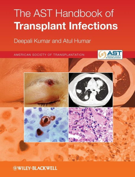 The AST Handbook of Transplant Infections / Edition 1