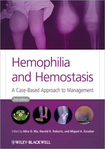 Hemophilia and Hemostasis: A Case-Based Approach to Management / Edition 2