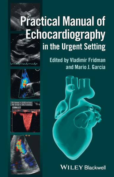 Practical Manual of Echocardiography in the Urgent Setting / Edition 1