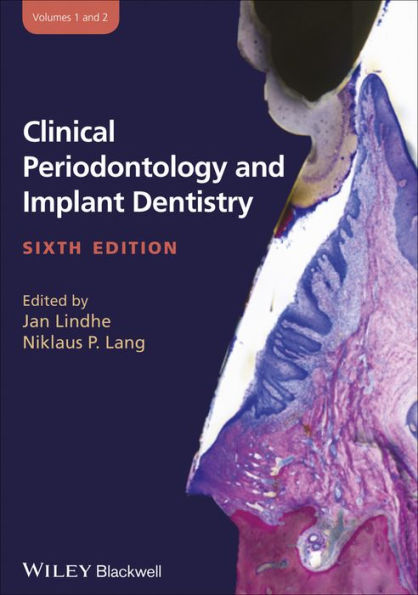 Clinical Periodontology and Implant Dentistry, 2 Volume Set / Edition 6