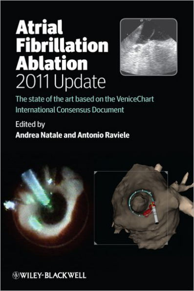Atrial Fibrillation Ablation, 2011 Update: The State of the Art based on the VeniceChart International Consensus Document / Edition 1