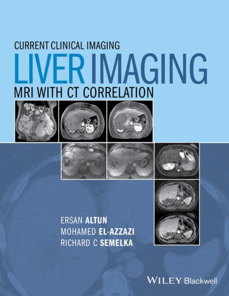 Liver Imaging: MRI with CT Correlation / Edition 1