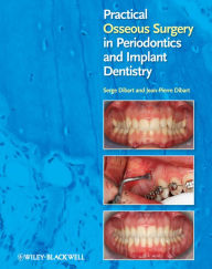 Title: Practical Osseous Surgery in Periodontics and Implant Dentistry, Author: Serge Dibart