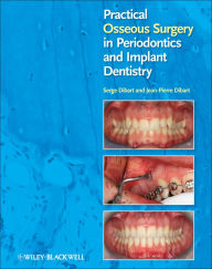Title: Practical Osseous Surgery in Periodontics and Implant Dentistry, Author: Serge Dibart