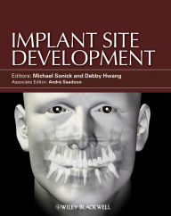 Title: Implant Site Development, Author: Michael Sonick