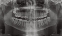 Alternative view 3 of The Surreal Visions of Hernán Díaz Alonso/HDA-X