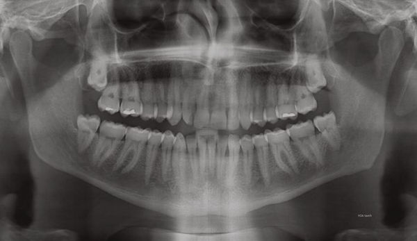 The Surreal Visions of Hernán Díaz Alonso/HDA-X