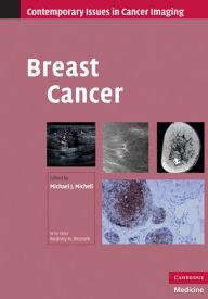 Title: Breast Cancer, Author: Michael J. Michell