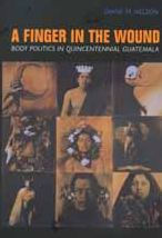 Title: A Finger in the Wound: Body Politics in Quincentennial Guatemala, Author: Diane M. Nelson