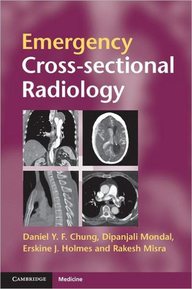 Emergency Cross-sectional Radiology