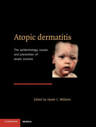 Title: Atopic Dermatitis: The Epidemiology, Causes and Prevention of Atopic Eczema / Edition 1, Author: Hywel C. Williams