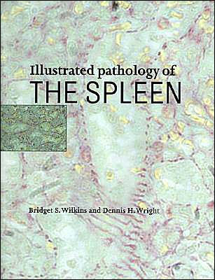 Illustrated Pathology of the Spleen / Edition 1