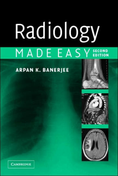 Radiology Made Easy / Edition 2