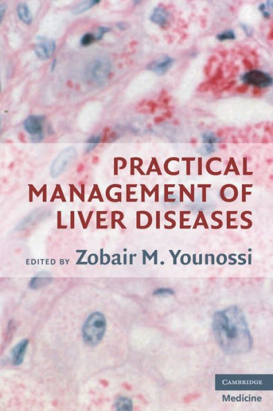 Practical Management of Liver Diseases