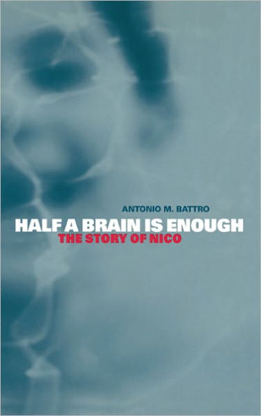 Half a Brain is Enough: The Story of Nico