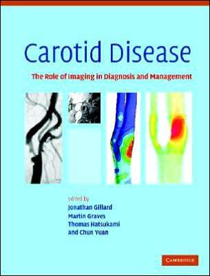 Carotid Disease: The Role of Imaging in Diagnosis and Management