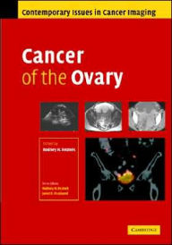 Title: Cancer of the Ovary, Author: Rodney Reznek