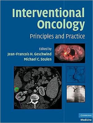 Interventional Oncology: Principles and Practice