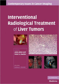 Title: Interventional Radiological Treatment of Liver Tumors, Author: Andy Adam