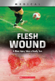Title: Flesh Wound: A Minor Injury Takes a Deadly Turn (XBooks), Author: Shea Phillips