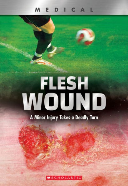 Flesh Wound: A Minor Injury Takes a Deadly Turn (XBooks)